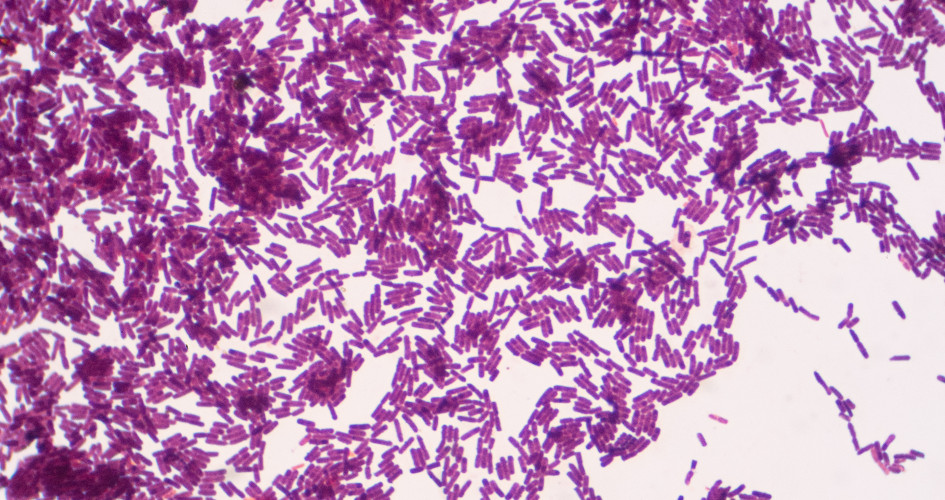 Lorem ipsum dolor sit amet, consectetur adipiscing elit. Etiam imperdiet vel ipsum ut dictum