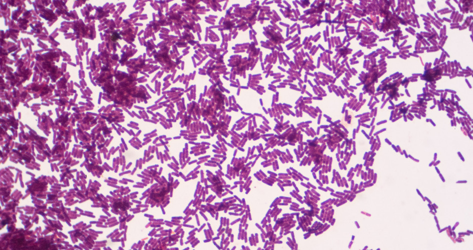 Lorem ipsum dolor sit amet, consectetur adipiscing elit. Etiam imperdiet vel ipsum ut dictum